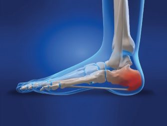 heel pain that radiates to ankle